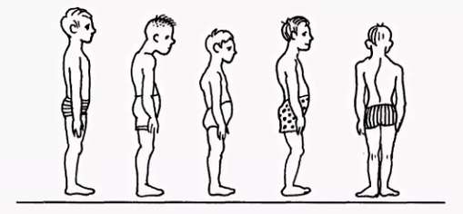 Violation de la posture