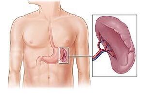 pathologie de la rate comme cause de douleur sous l'omoplate gauche