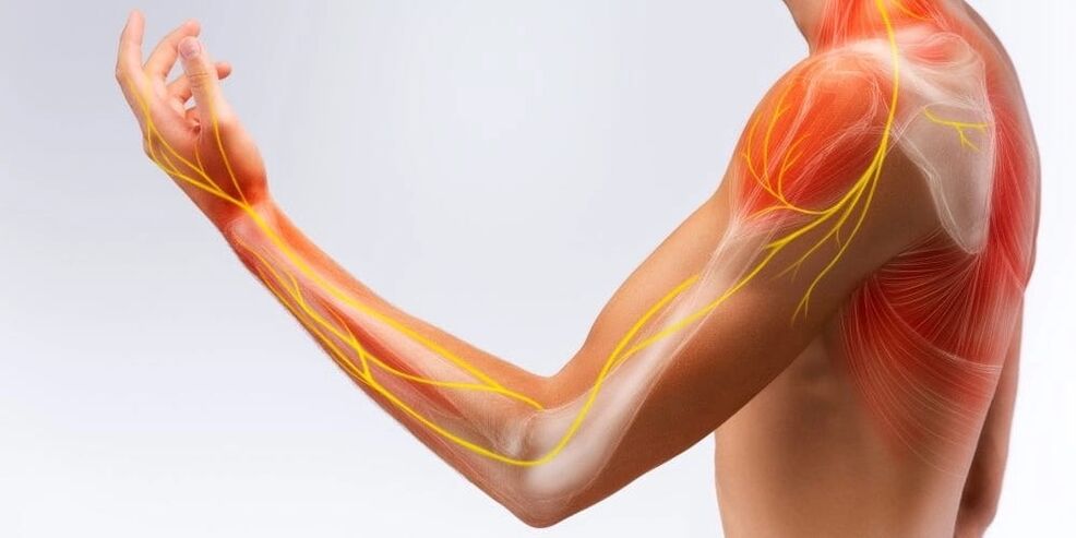 La douleur et l'engourdissement des doigts indiquent des dommages aux ligaments dus à une ligamentite sténosante